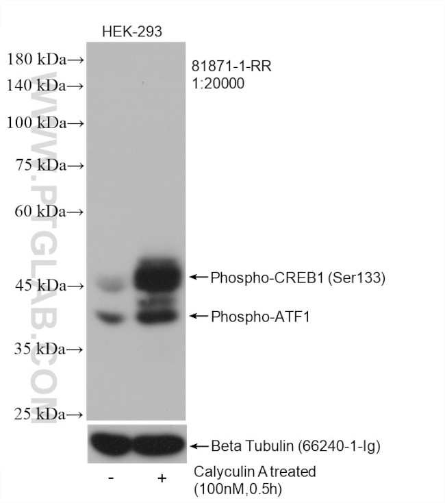 Phospho-CREB1 (Ser133) Antibody in Western Blot (WB)