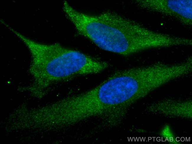 USP9X Antibody in Immunocytochemistry (ICC/IF)