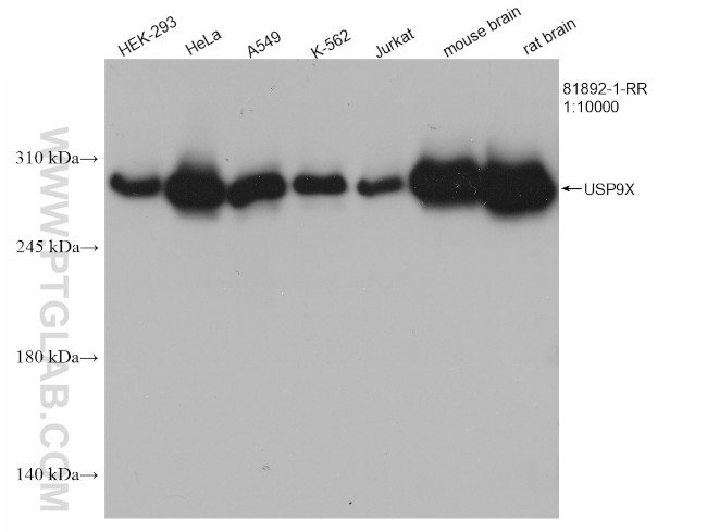 USP9X Antibody in Western Blot (WB)