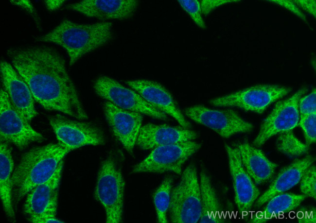 DDX3 Antibody in Immunocytochemistry (ICC/IF)