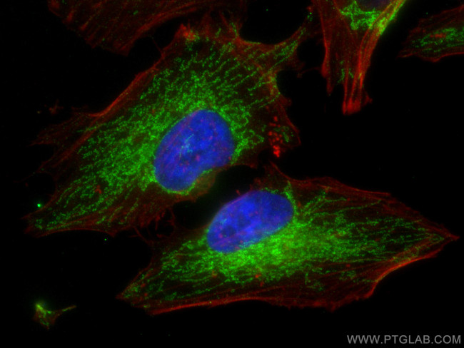 MAVS/VISA Antibody in Immunocytochemistry (ICC/IF)