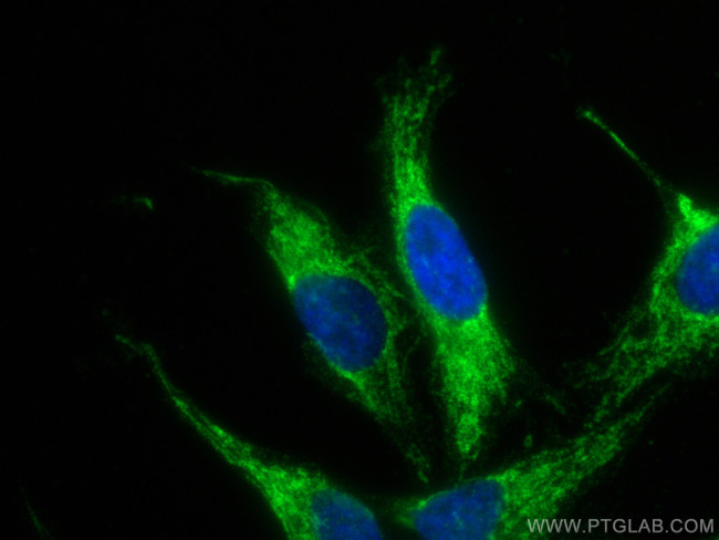 MAVS/VISA Antibody in Immunocytochemistry (ICC/IF)