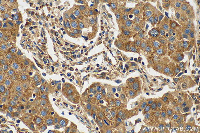 MAVS/VISA Antibody in Immunohistochemistry (Paraffin) (IHC (P))