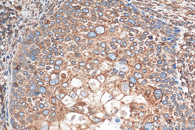 Calnexin Antibody in Immunohistochemistry (Paraffin) (IHC (P))