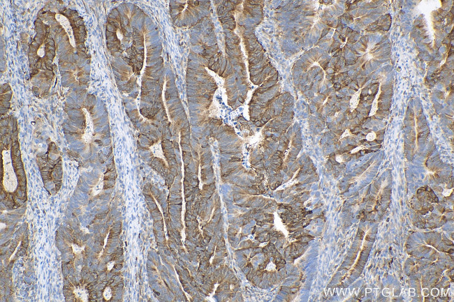 PHGDH Antibody in Immunohistochemistry (Paraffin) (IHC (P))