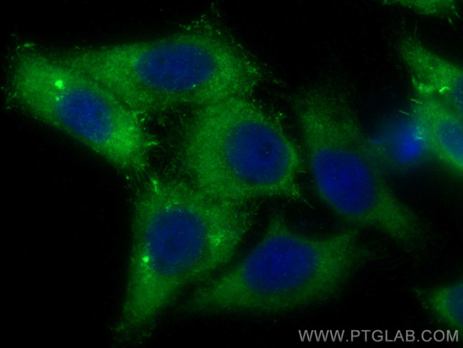 Moesin Antibody in Immunocytochemistry (ICC/IF)