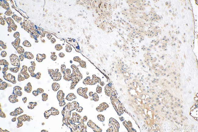 Moesin Antibody in Immunohistochemistry (Paraffin) (IHC (P))