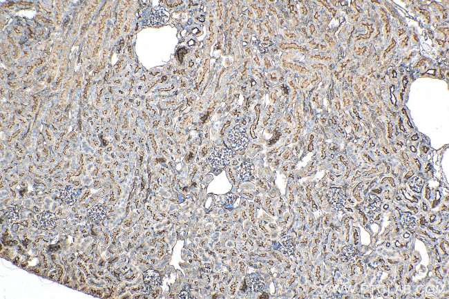 Moesin Antibody in Immunohistochemistry (Paraffin) (IHC (P))