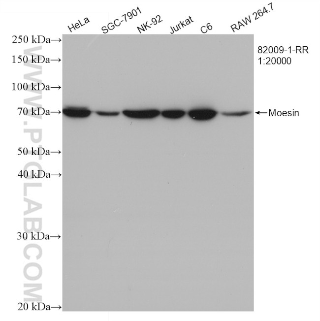 Moesin Antibody in Western Blot (WB)