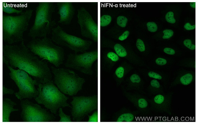 STAT1 Antibody in Immunocytochemistry (ICC/IF)