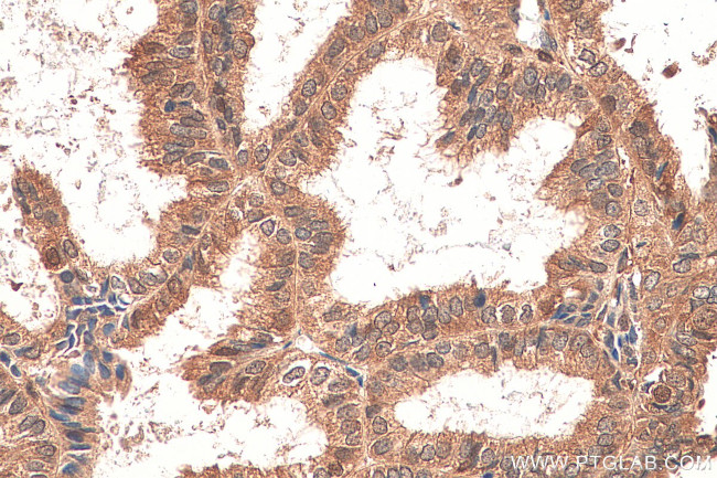 STAT1 Antibody in Immunohistochemistry (Paraffin) (IHC (P))