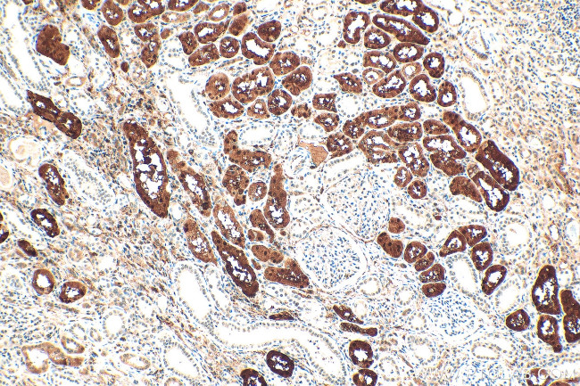 ZEB2 Antibody in Immunohistochemistry (Paraffin) (IHC (P))