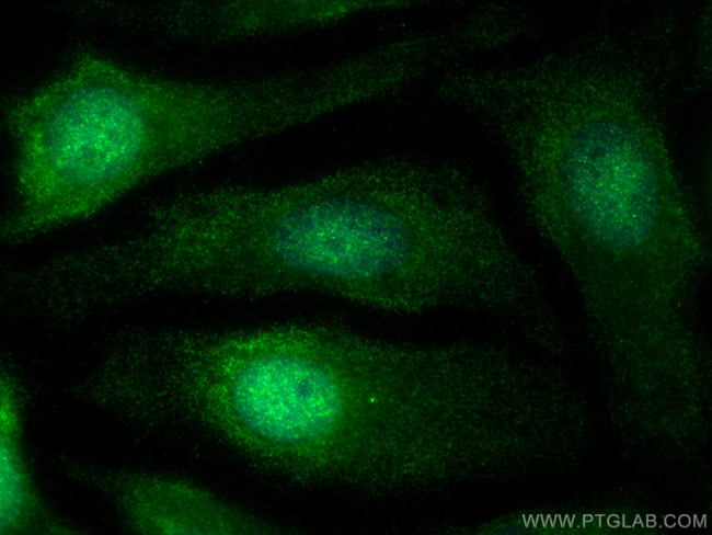 Galectin 3 Antibody in Immunocytochemistry (ICC/IF)