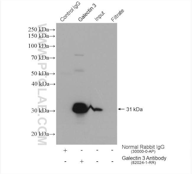 Galectin 3 Antibody in Immunoprecipitation (IP)