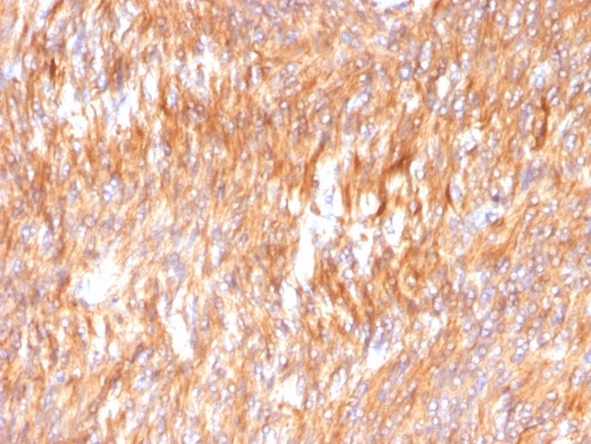 Calnexin Antibody in Immunohistochemistry (Paraffin) (IHC (P))