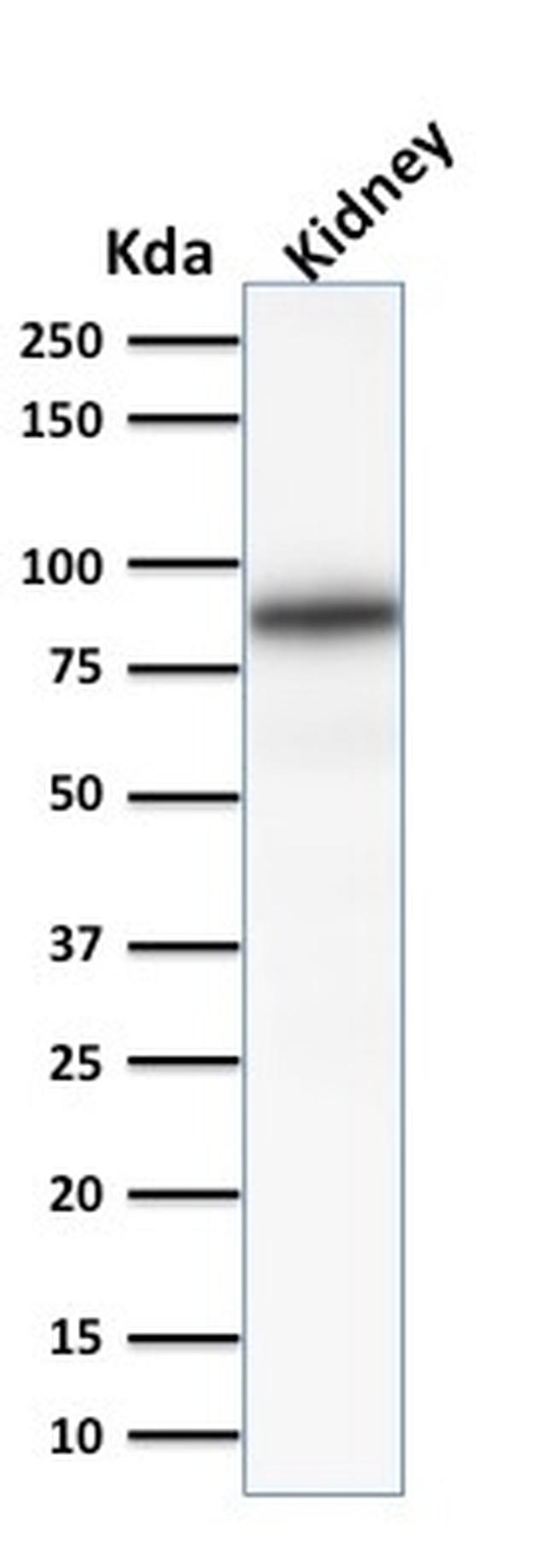 Calnexin Antibody in Western Blot (WB)