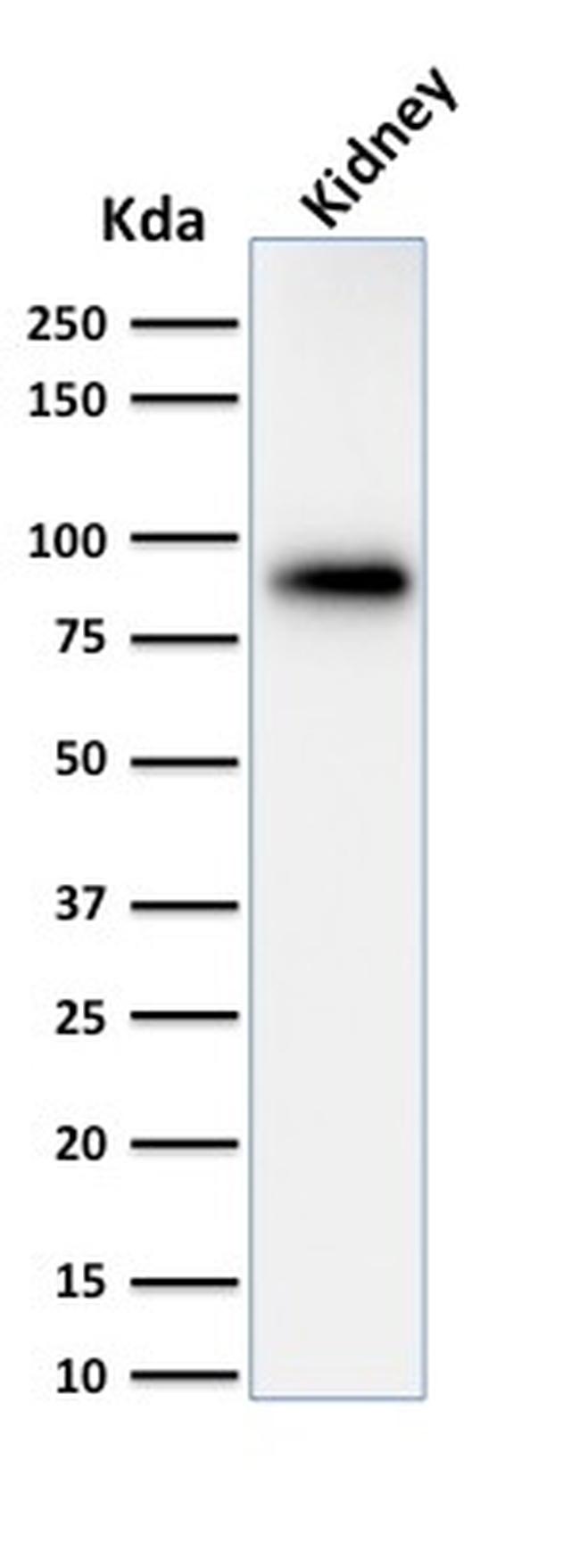 Calnexin Antibody in Western Blot (WB)