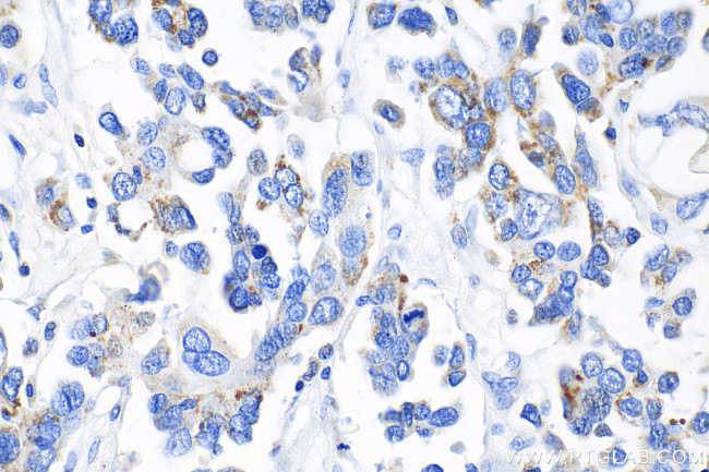 IDH2 Antibody in Immunohistochemistry (Paraffin) (IHC (P))