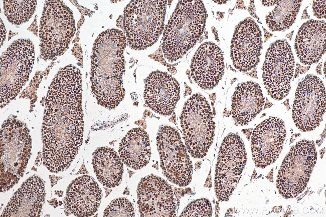 DHX15 Antibody in Immunohistochemistry (Paraffin) (IHC (P))