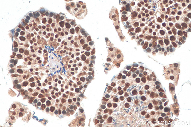 DHX15 Antibody in Immunohistochemistry (Paraffin) (IHC (P))