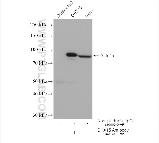 DHX15 Antibody in Immunoprecipitation (IP)