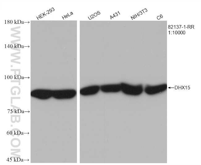 DHX15 Antibody in Western Blot (WB)