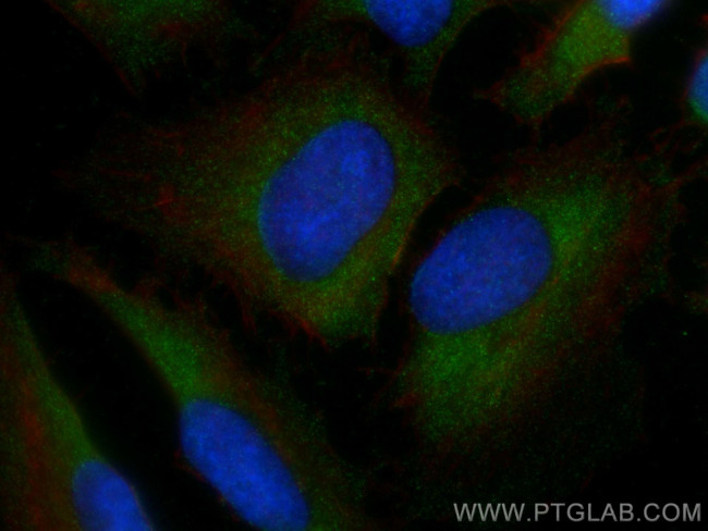 Caspase 3 Antibody in Immunocytochemistry (ICC/IF)