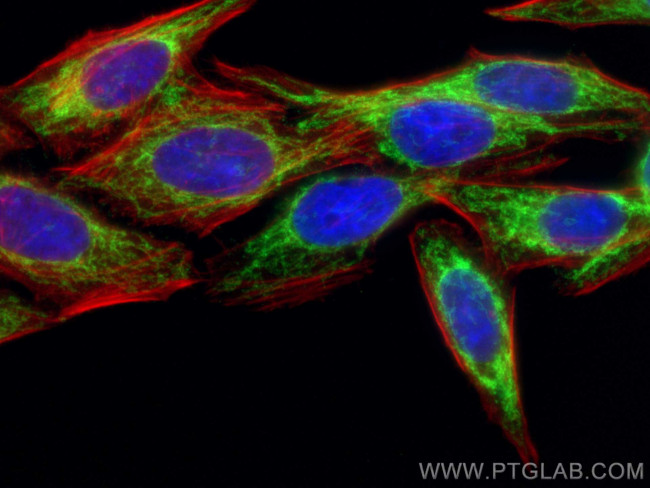 FIS1 Antibody in Immunocytochemistry (ICC/IF)