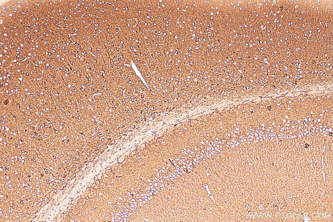 ATP5A1 Antibody in Immunohistochemistry (Paraffin) (IHC (P))