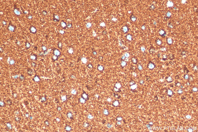 ATP5A1 Antibody in Immunohistochemistry (Paraffin) (IHC (P))