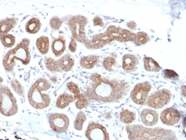 Calpain 1 Antibody in Immunohistochemistry (Paraffin) (IHC (P))