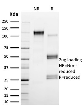 Calpain 1 Antibody in SDS-PAGE (SDS-PAGE)