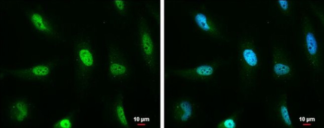 ATM Antibody in Immunocytochemistry (ICC/IF)