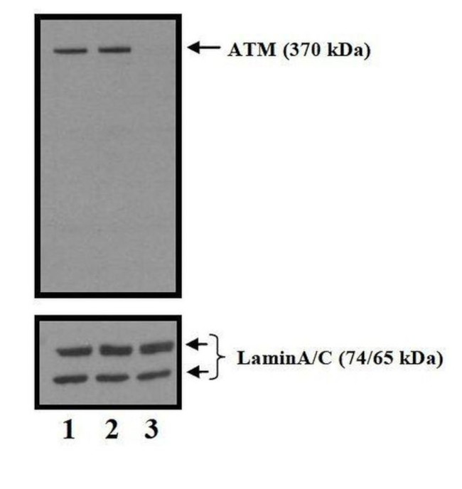 ATM Antibody