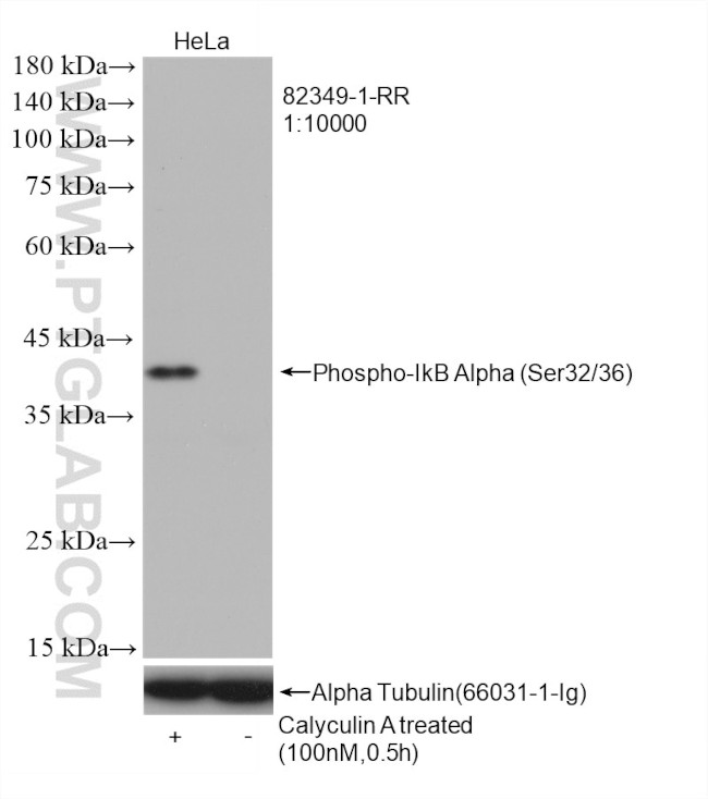 Phospho-IkB Alpha (Ser32, Ser36) Antibody in Western Blot (WB)