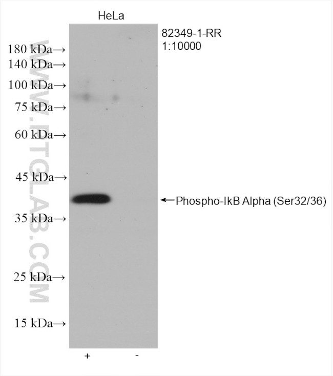 Phospho-IkB Alpha (Ser32, Ser36) Antibody in Western Blot (WB)