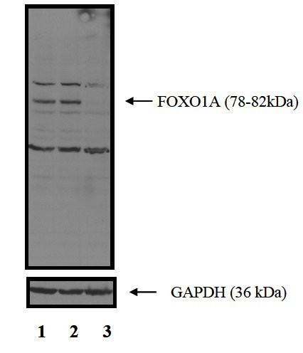 FOXO1 Antibody in Western Blot (WB)