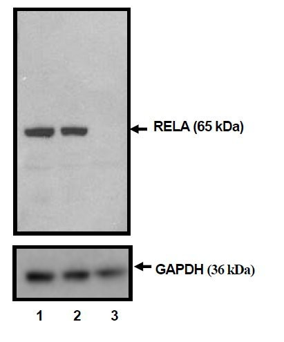 NFkB p65 Antibody in Western Blot (WB)