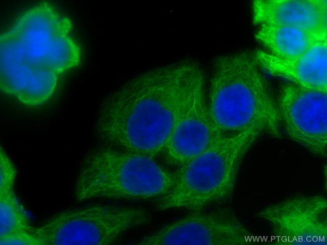 Cytokeratin 20 Antibody in Immunocytochemistry (ICC/IF)