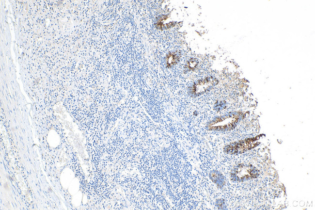 Cytokeratin 20 Antibody in Immunohistochemistry (Paraffin) (IHC (P))