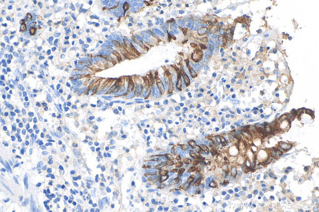 Cytokeratin 20 Antibody in Immunohistochemistry (Paraffin) (IHC (P))