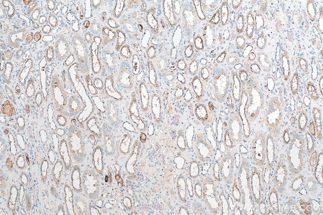 Cystatin C Antibody in Immunohistochemistry (Paraffin) (IHC (P))