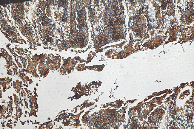 VCP Antibody in Immunohistochemistry (Paraffin) (IHC (P))