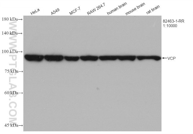 VCP Antibody in Western Blot (WB)