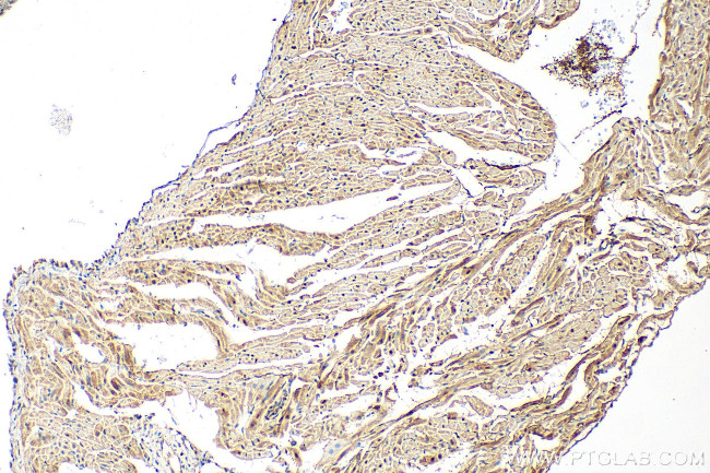 PTPN11 Antibody in Immunohistochemistry (Paraffin) (IHC (P))