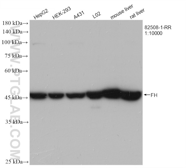 FH Antibody in Western Blot (WB)