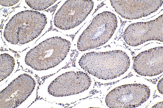 WT1 Antibody in Immunohistochemistry (Paraffin) (IHC (P))