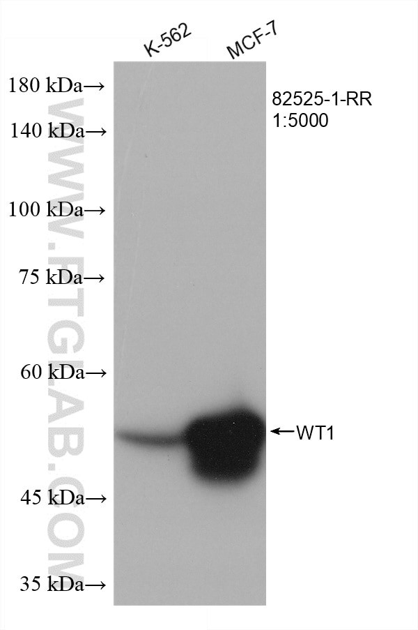 WT1 Antibody in Western Blot (WB)