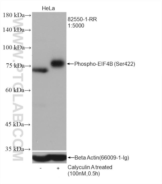 Phospho-EIF4B (Ser422) Antibody in Western Blot (WB)