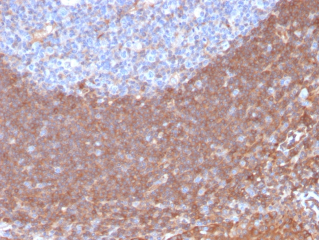 Calpastatin Antibody in Immunohistochemistry (Paraffin) (IHC (P))